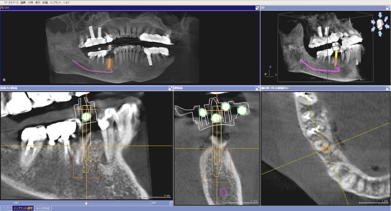 コンピューターガイド